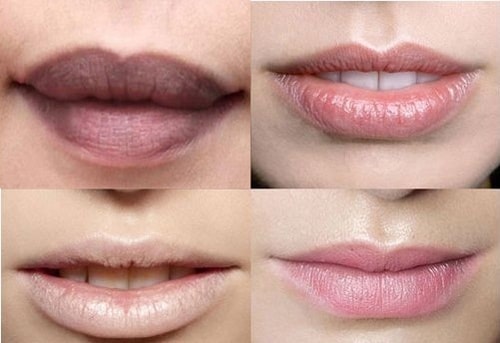 Phun môi collagen là gì và nên phun môi màu nào đẹp?