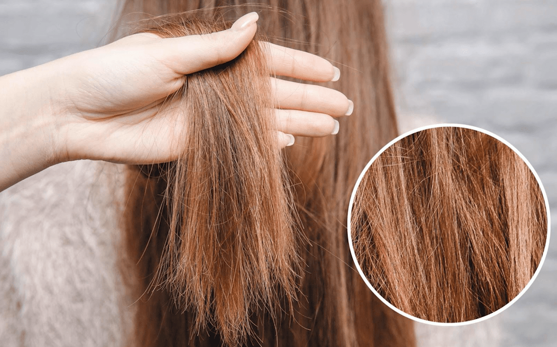 Tóc xơ do đâu và phải làm sao để tóc nhanh hồi phục?